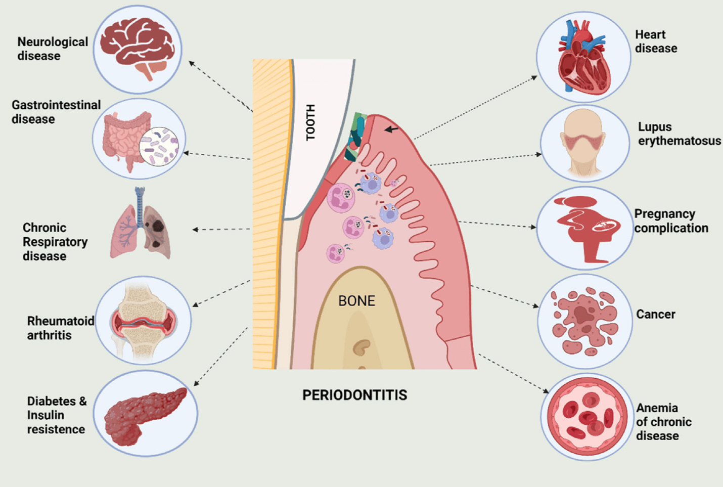 Representation of diverse systemic diseases and their relationship with periodontitis.