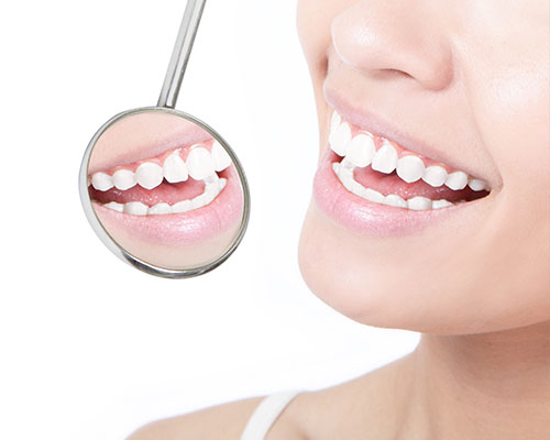 Composite VS Silver Fillings