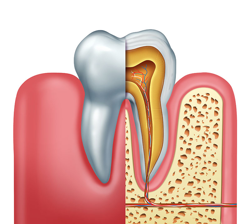 what is involved in root canal therapy